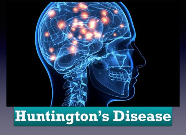 Image for event: Huntington's Disease Support Group via Zoom